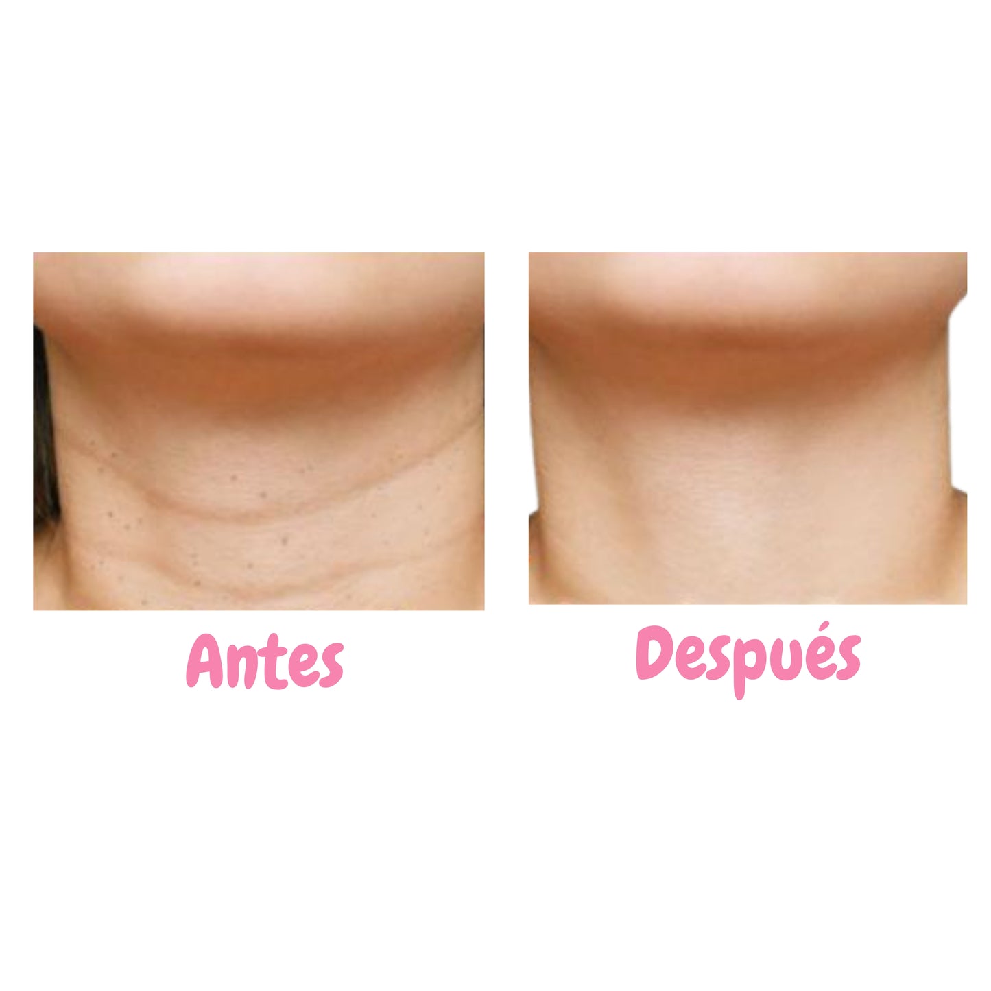 Crema para el cuello - Neck Smash Premium